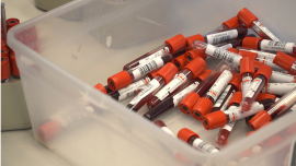 Niewielki odsetek Polaków robi testy na HIV. Wirus może pozostawać w uśpieniu nawet 10 lat News powiązane z pandemia a testy na HIV