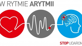 ZESPÓŁ PECTUS gra w rytmie… arytmii