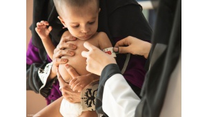 80% dzieci w Jemenie wymaga pomocy humanitarnej. Najmłodsi umierają z głodu Biuro prasowe