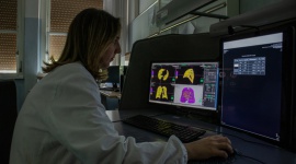 Synapse 3D ułatwia zarządzanie diagnostyką pacjentów podczas pandemii COVID19