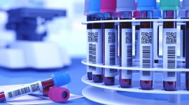 Minimalizowanie ryzyka błędu w laboratoriach medycznych.